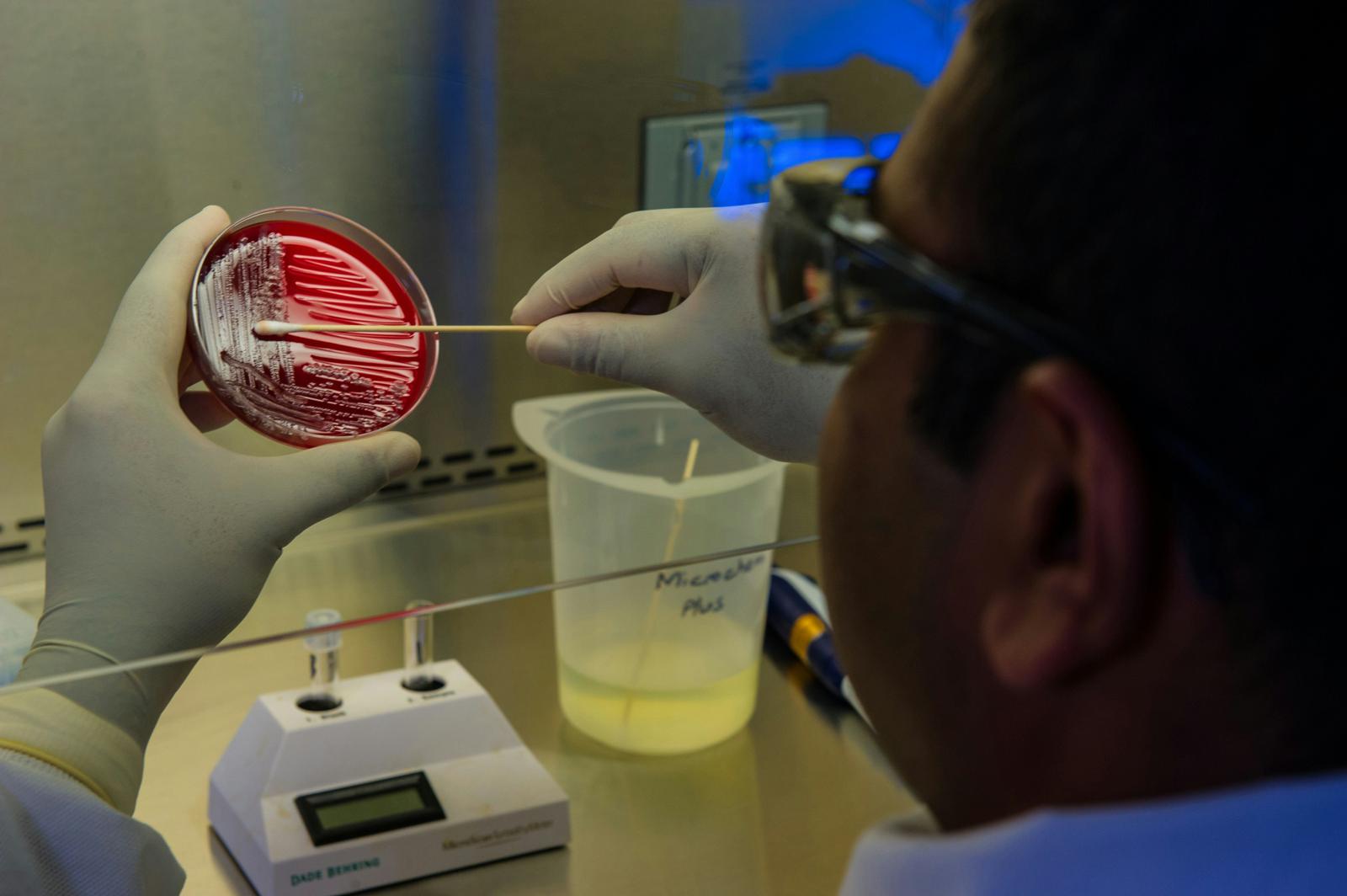CDC confirma seis muertes por brote de Listeria en alimentos listos