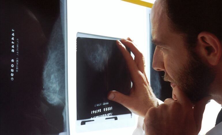 El cáncer de próstata repunta en EE.UU. tras una década a la baja